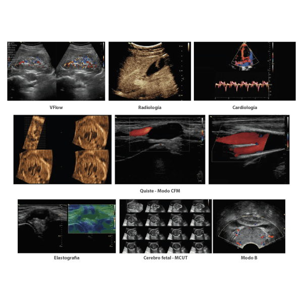 Imágenes diagnosticas VINNO D55 VET veterinario